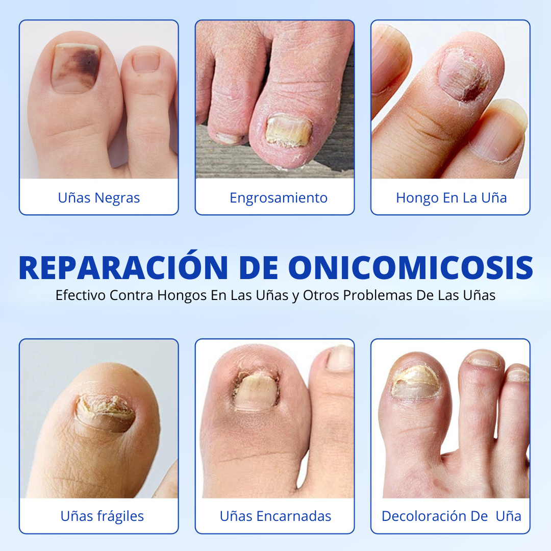 Simpli™ NailCare