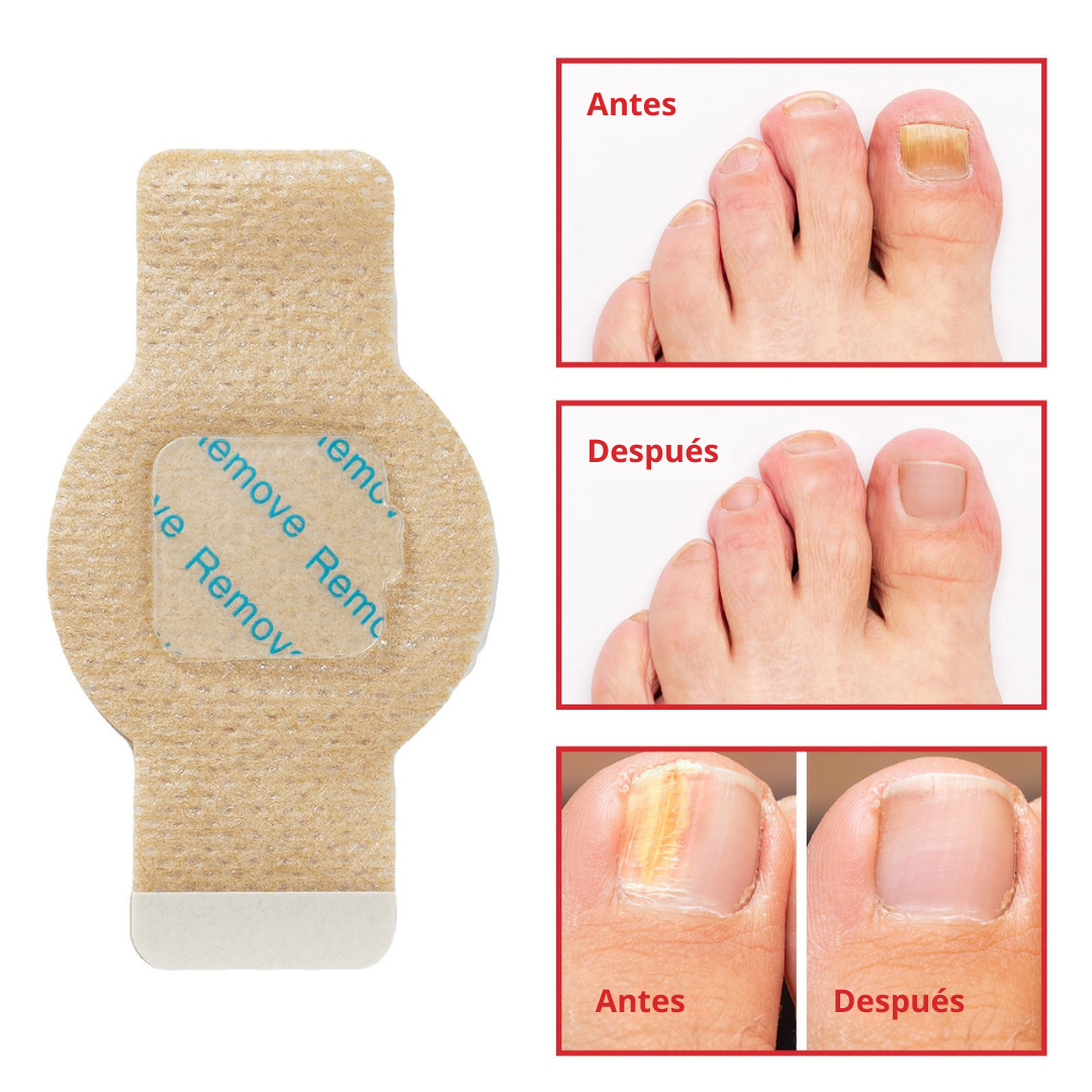 Simpli™ NailCare
