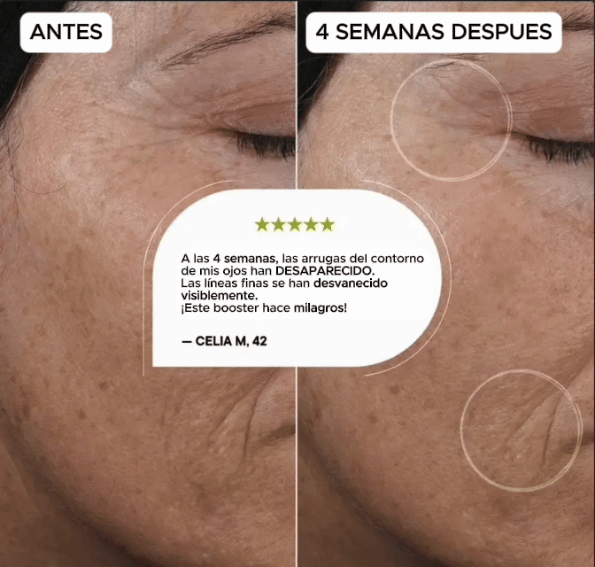 Crema Retinal Simpli™