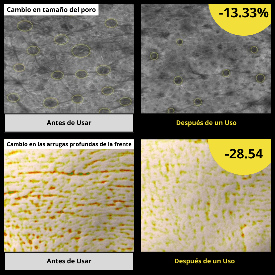 Crema Retinal Simpli™