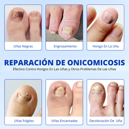 Simpli™ NailCare