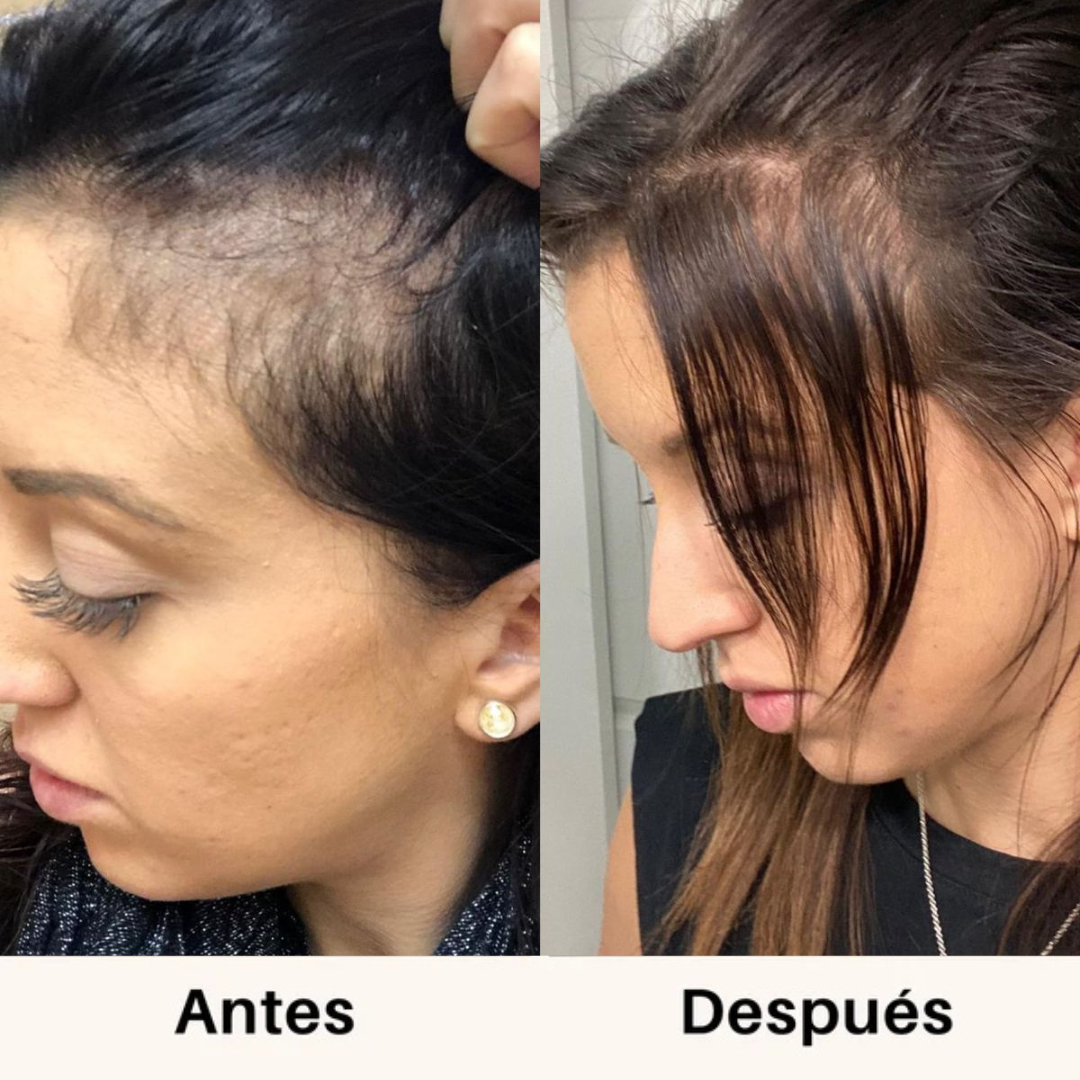 Simpli™ Hair Growth