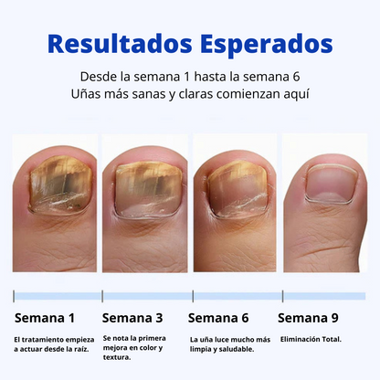 Simpli™ NailCare