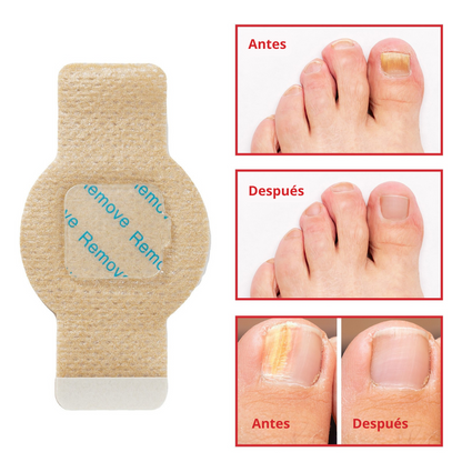 Simpli™ NailCare